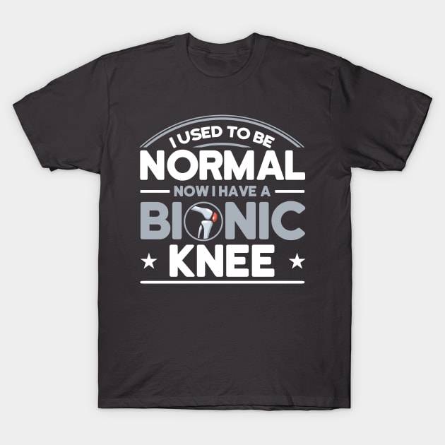 Patients I Used To Be Normal Bionic Knee Knee Replacement T-Shirt by Toeffishirts